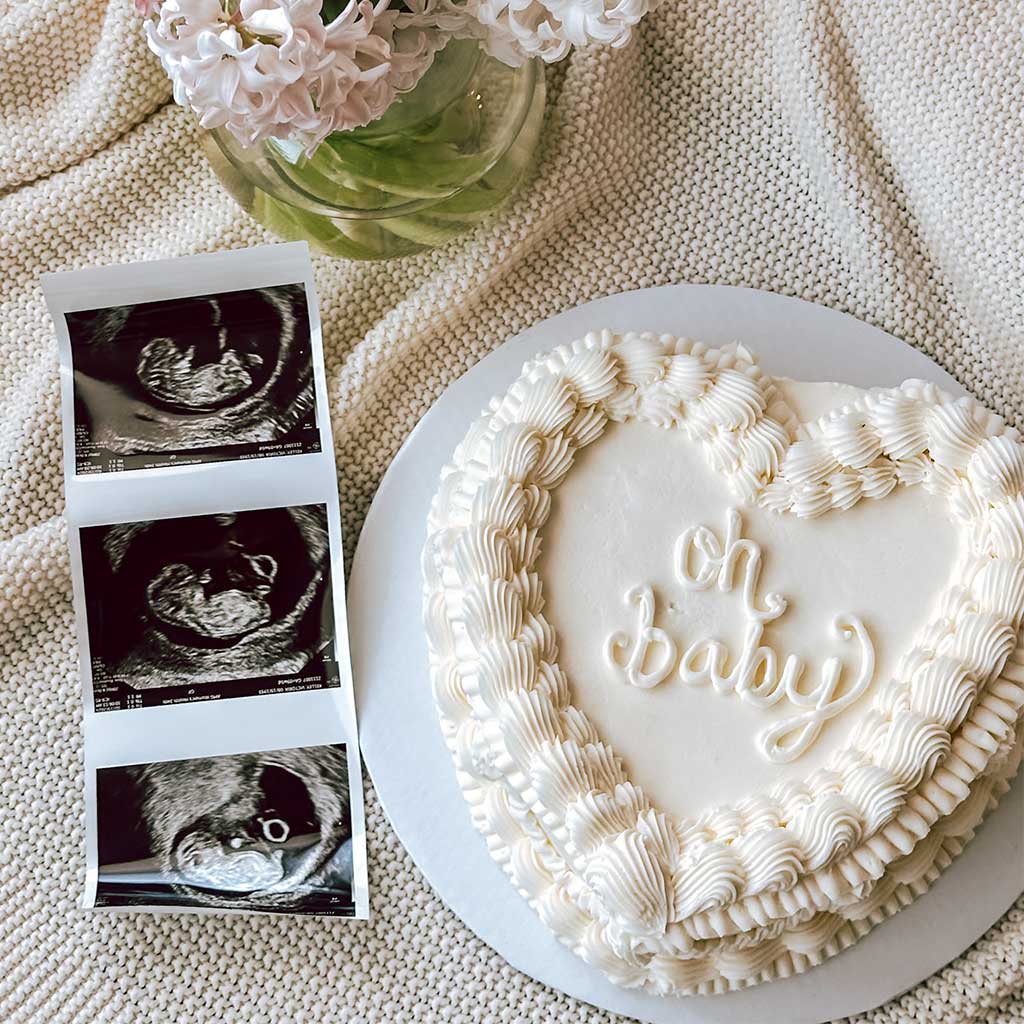 Oh My God, We’re Having a&nbsp;Baby